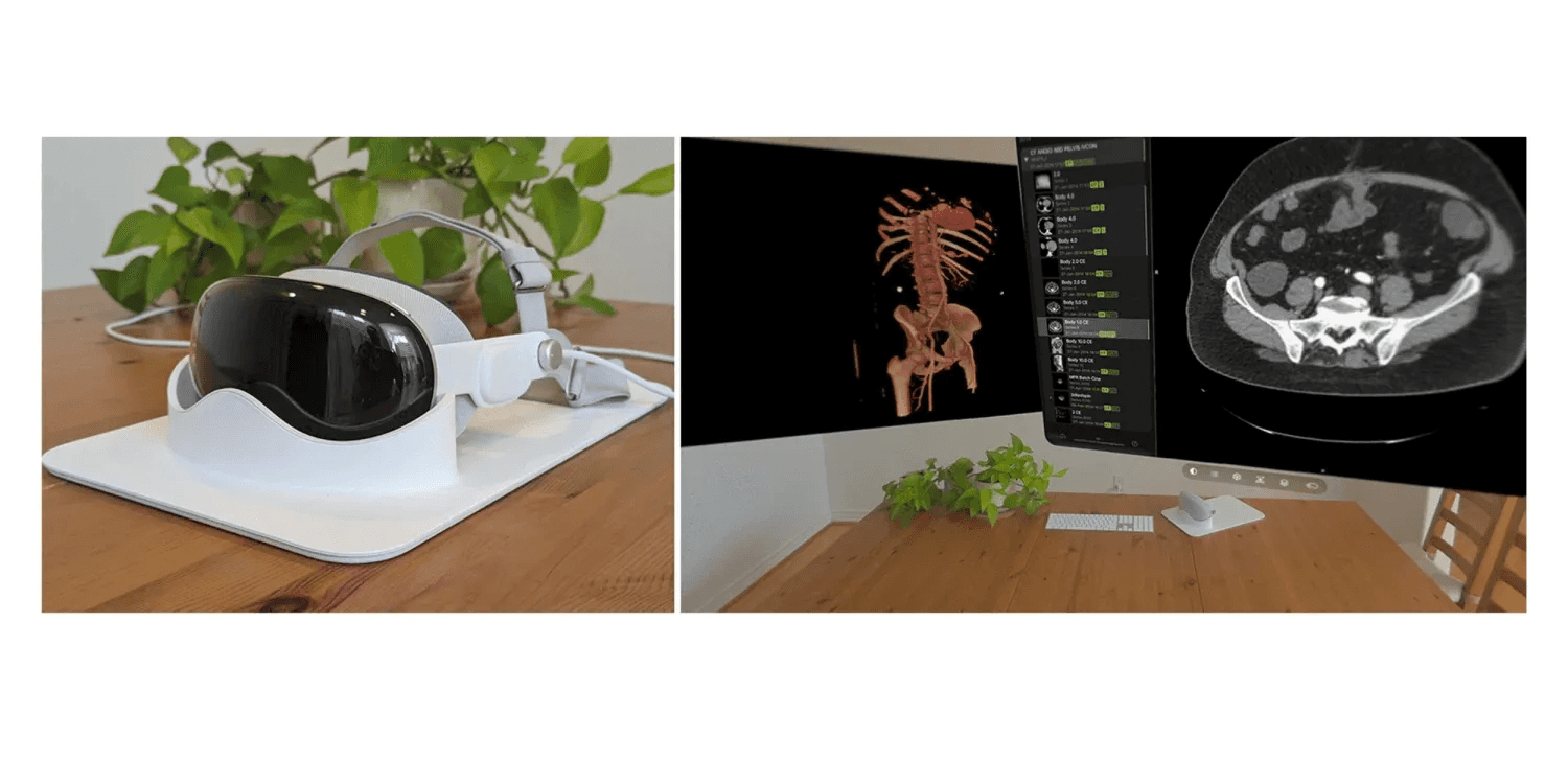 Apple Vision Pro у медичних закладах: нові можливості для діагностики та 3D візуалізації