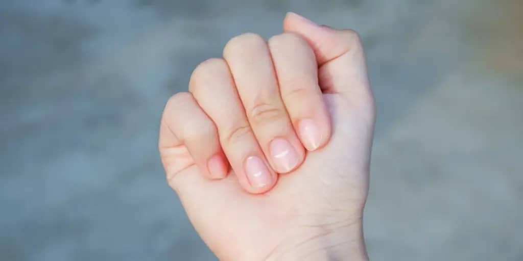 Чому на нігтях з’являються білі точки та смужки