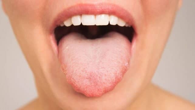 Бактерії у роті можуть впливати на швидкість вашого мислення