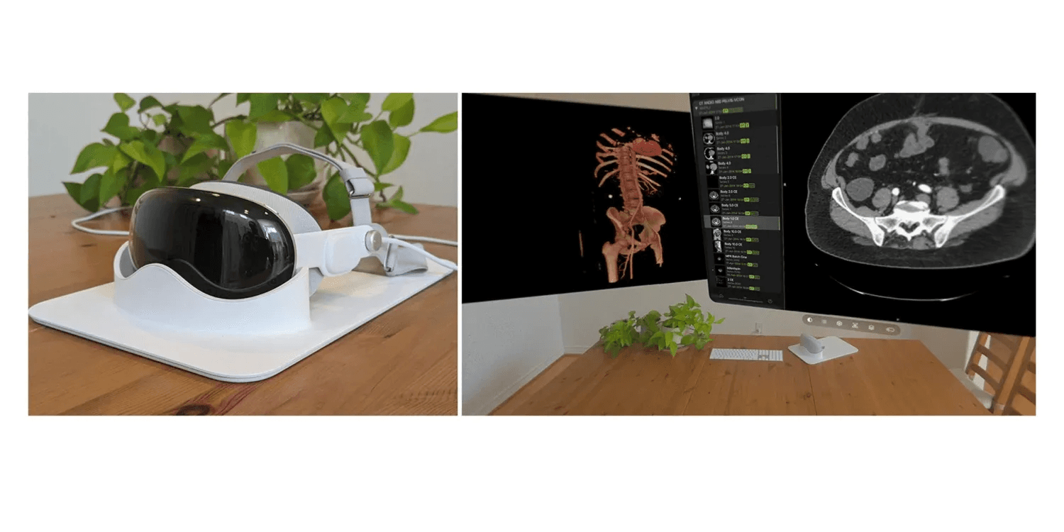 Apple Vision Pro у медичних закладах: нові можливості для діагностики та 3D візуалізації