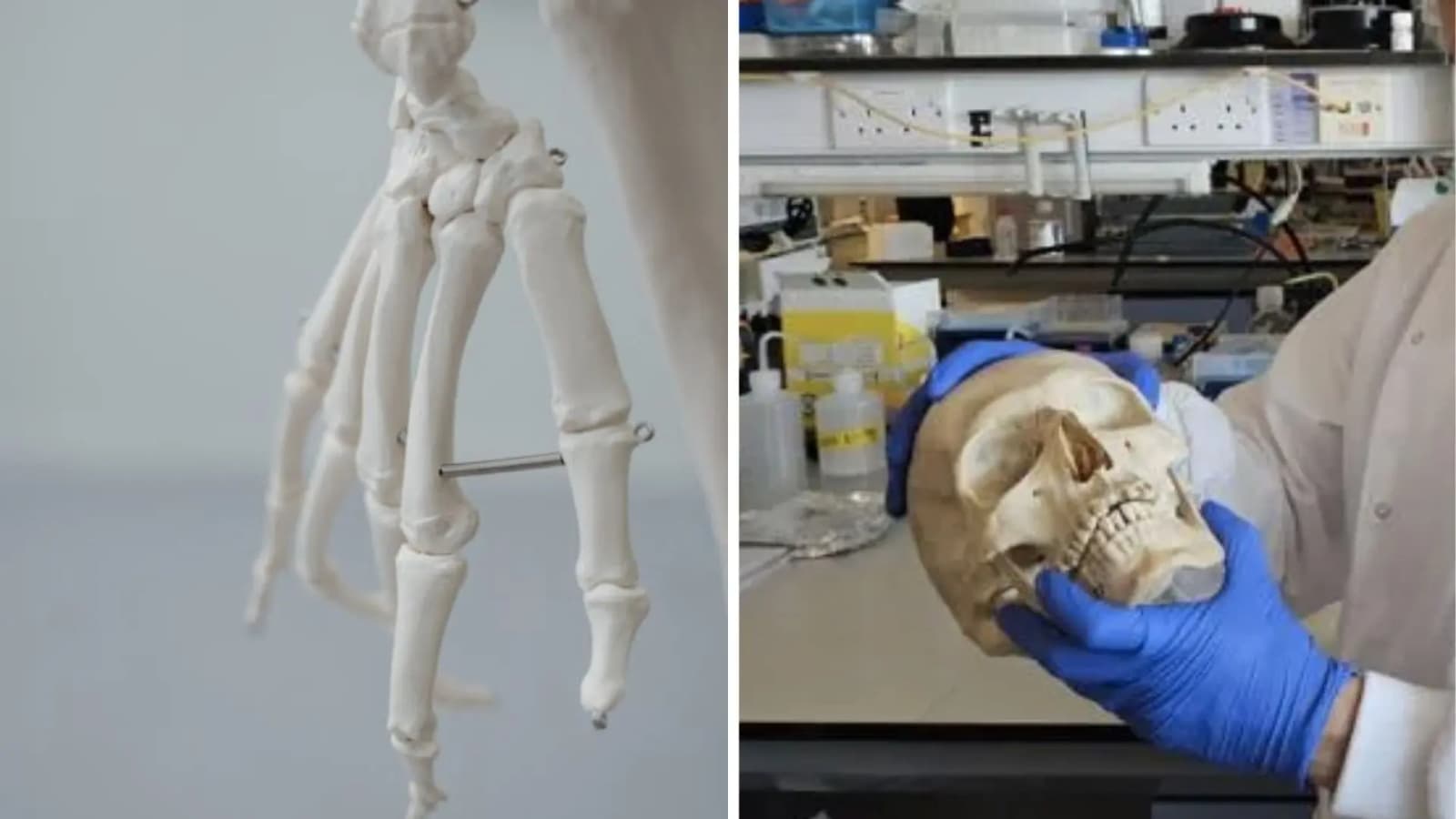 Вчені перетворили вовну на матеріал для відновлення кісток