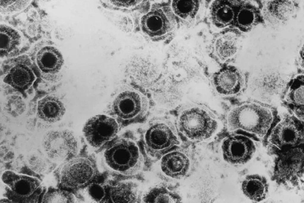 Спалах вірусу Oropouche вразив Європу