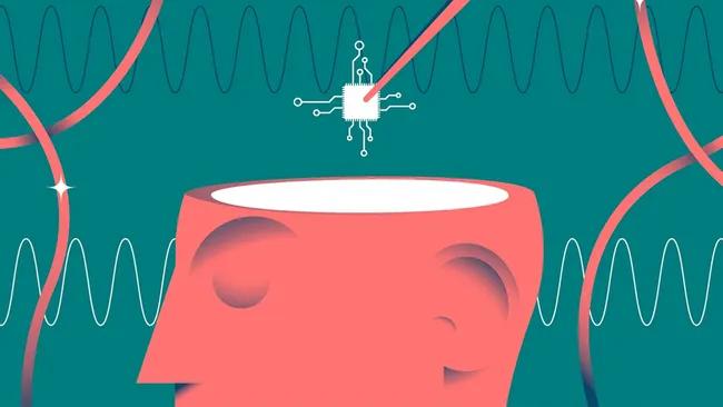 Перший користувач Neuralink описує плюси та мінуси життя з мозковим чіпом