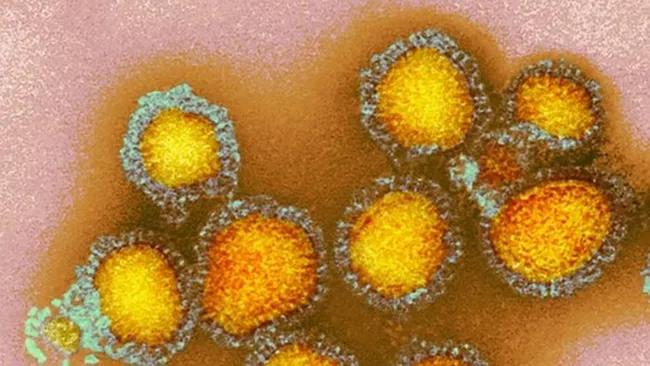 Пташиний грип вразив першу дитину в США — CDC заявляє, що джерело інфекції невідоме