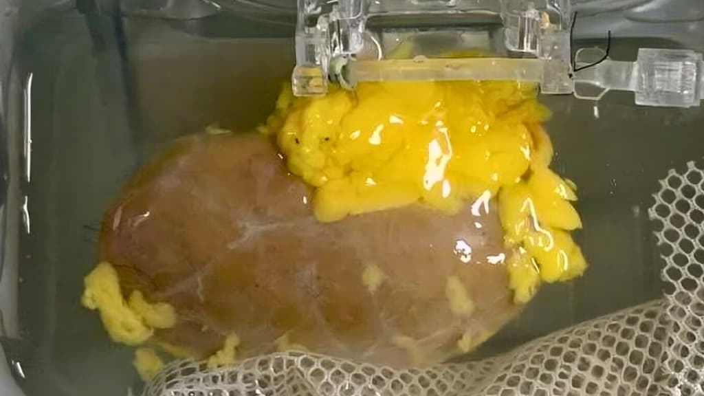 Вчені створили «універсальну» нирку, яка відповідає будь-якій групі крові