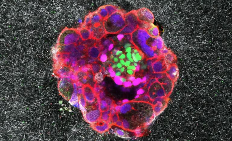 Вчені вперше зняли на відео процес імплантації людського ембріона в реальному часі