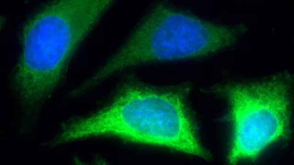 Вчені навчилися повертати старим тканинам регенерацію молодих клітин