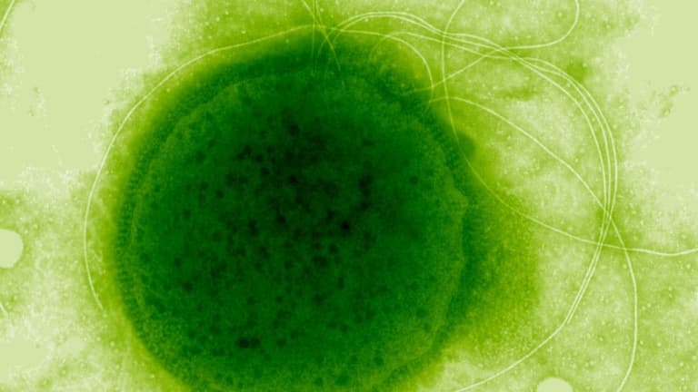 Цей надстійкий до радіації організм еволюціонував у дивовижну форму виживання