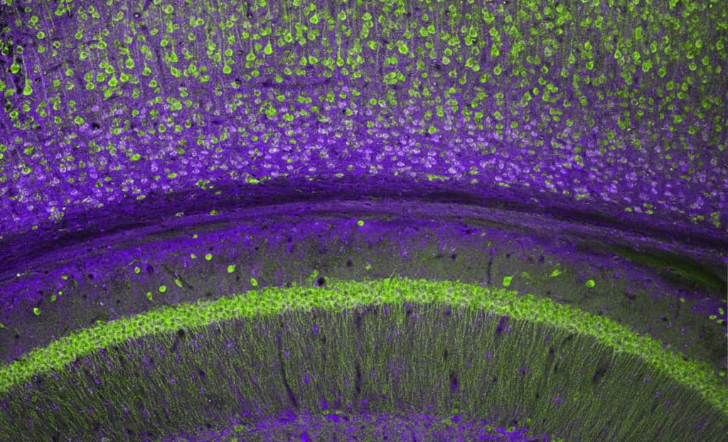 Вчені навчилися «редагувати» нейронні зв’язки для покращення пам’яті