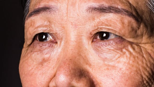 Ваш зір може передбачити деменцію за 12 років до діагнозу, стверджує дослідження