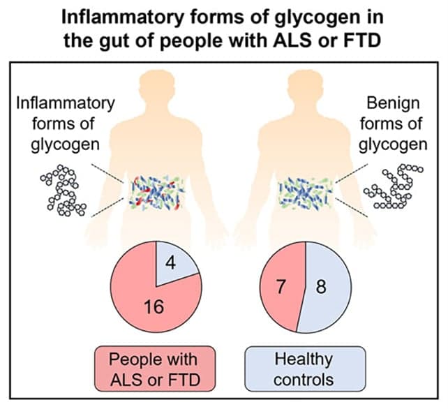 Бактерії в кишечнику можуть бути прихованим тригером нейродегенеративних захворювань