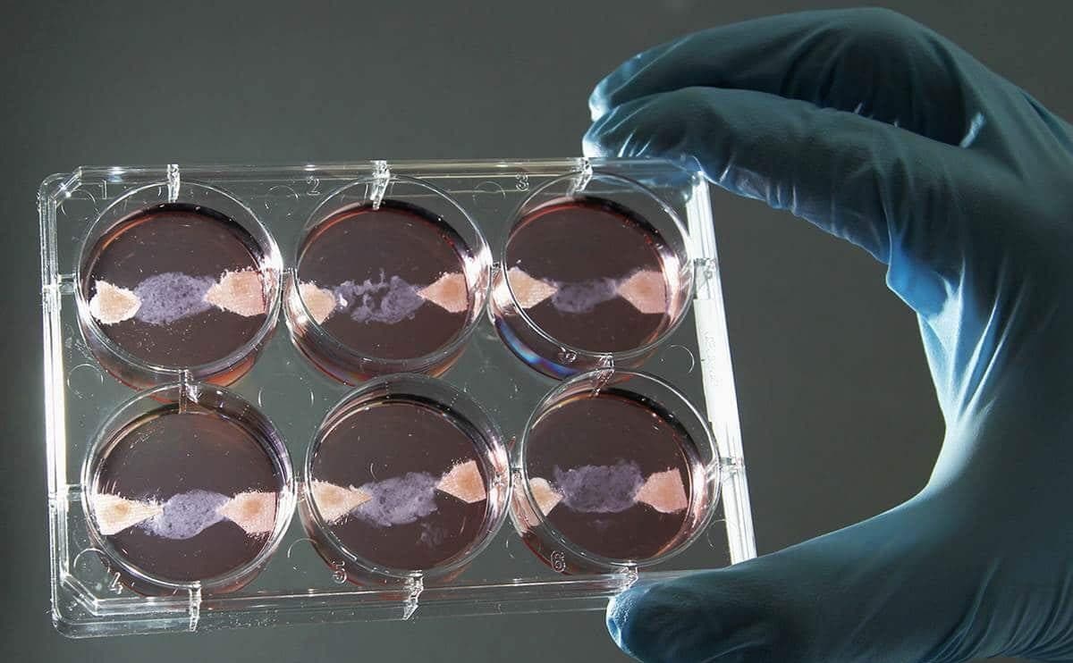 Вчені з Великої Британії вперше виростили людські зуби у лабораторії