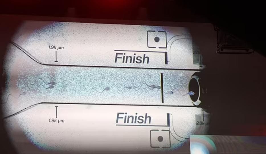 У США пройшли перші у світі перегони сперматозоїдів