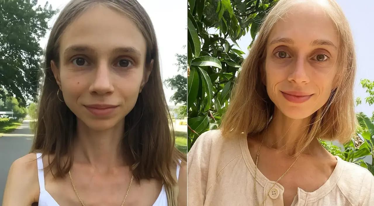 Померла на Балі після “фруктової дієти”: історія, яка шокувала світ