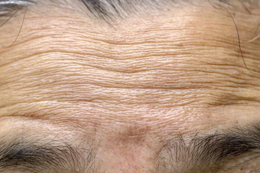 Вчені з’ясували, чому шкіра покривається зморшками під час старіння