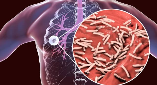 Звіт ВООЗ: одна інфекційна хвороба забрала більше мільйона життів у 2024 році