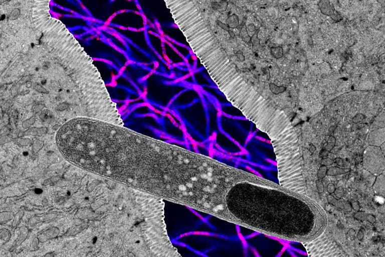 Фахівці виявили бактерію, яка перешкоджає набору ваги при жирній дієті