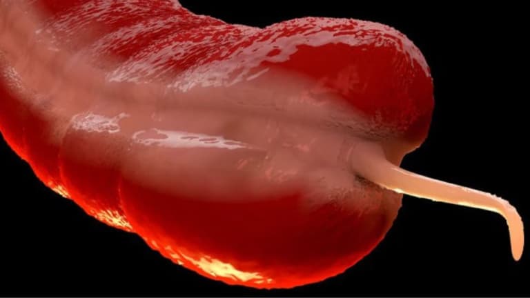 Тривожна тенденція: молодь масово хворіє на рідкісний вид раку