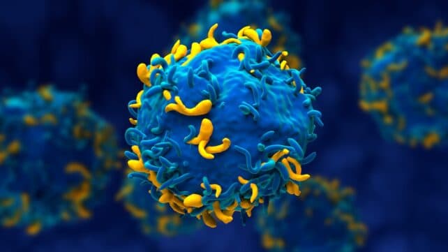 Жінка з трьома аутоімунними захворюваннями досягла ремісії після "перезавантаження" імунної системи