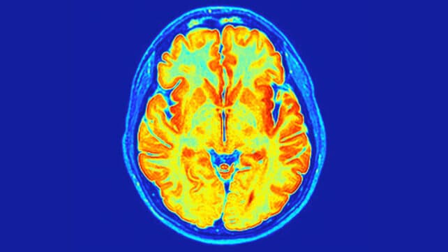 Вчені виявили новий нейророзвитковий розлад, прихований у наших генах
